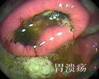θ
